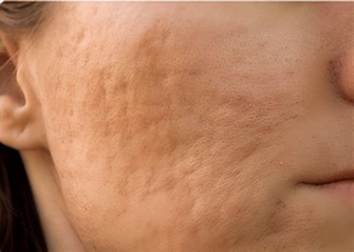 Are water spots permanent?
