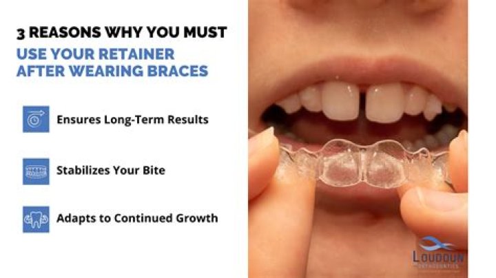 At what age can I stop wearing my retainer?