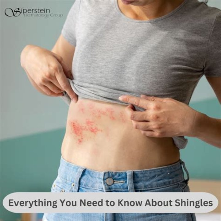 Can I be around my grandchildren if I have shingles?