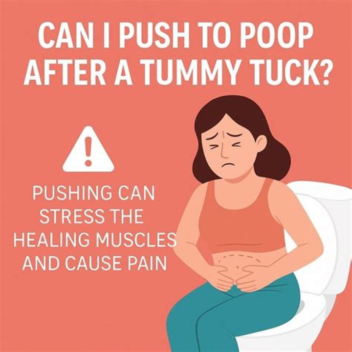 Can I push to poop after tummy tuck?