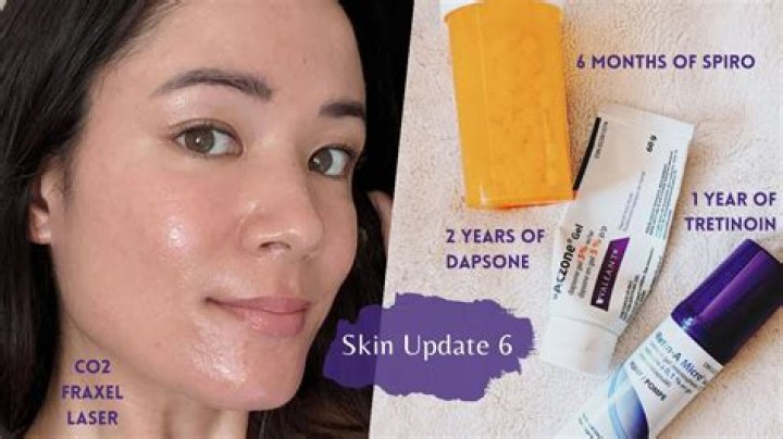 Can I use tretinoin every night?