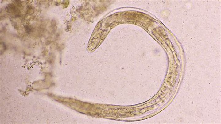 Can worms crawl under your skin?