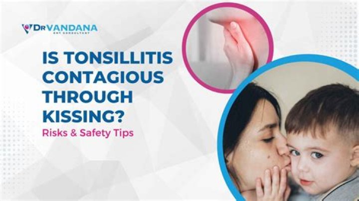 Can you get tonsillitis from kissing?
