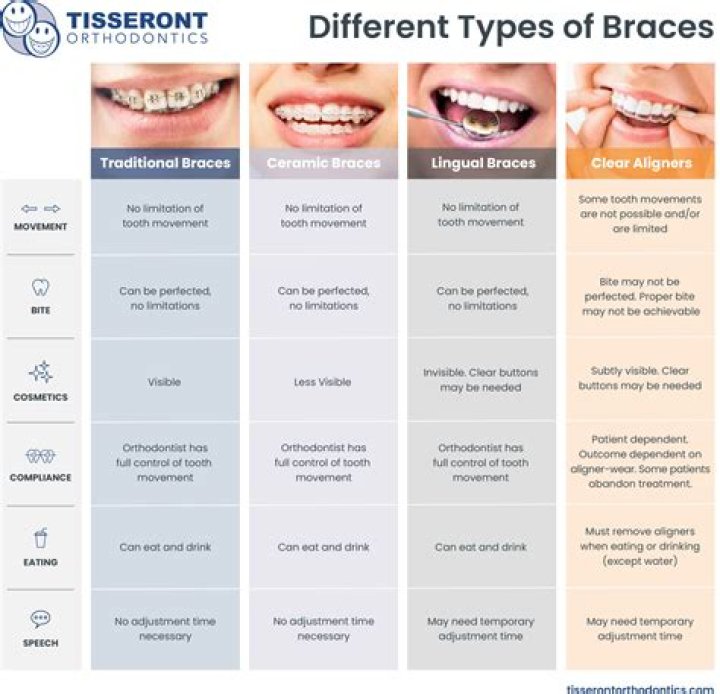 Can you keep braces on as long as you want?