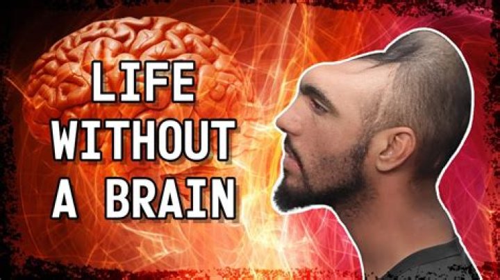 Can you live without a brain?