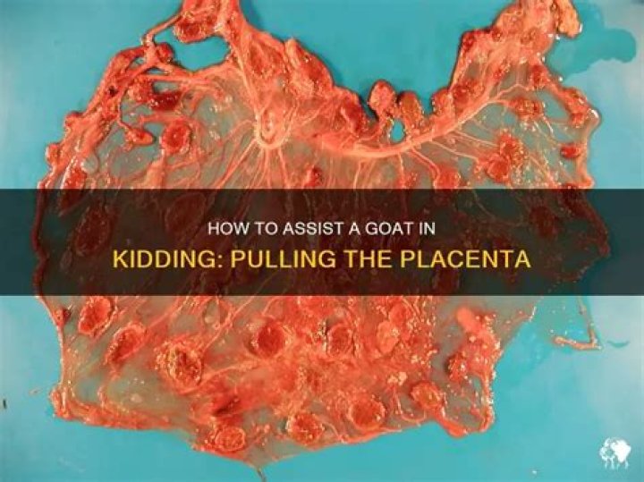 Can you pull the placenta out?