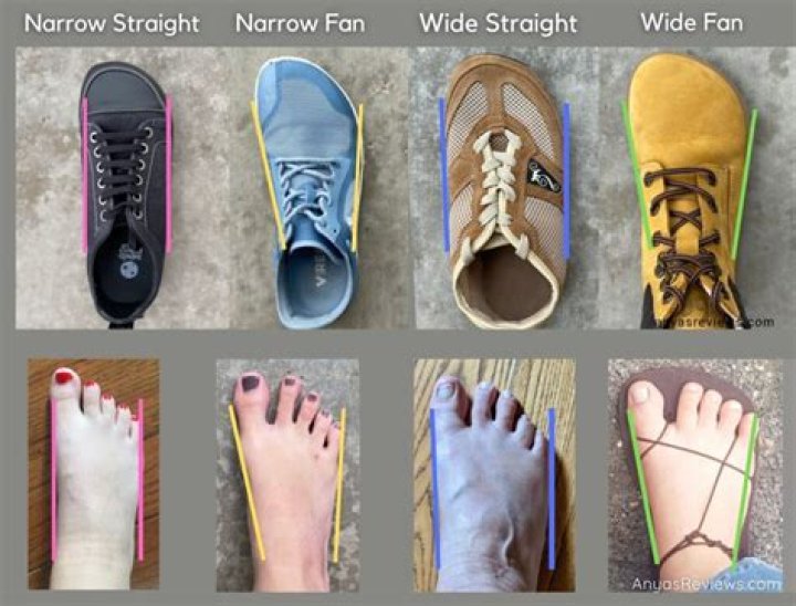 Do dog need shoes?