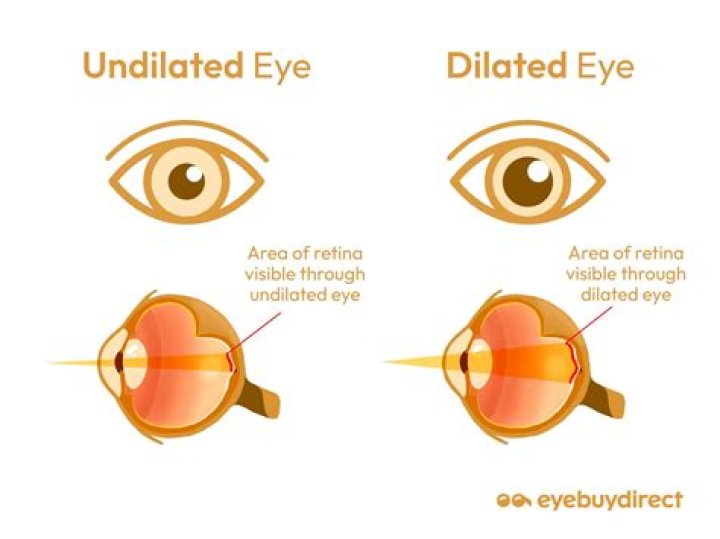 Do your eyes dilate when you die?