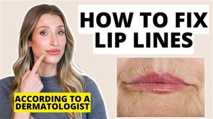 Does a lip lift get rid of wrinkles?