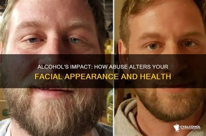 Does alcohol change your face?
