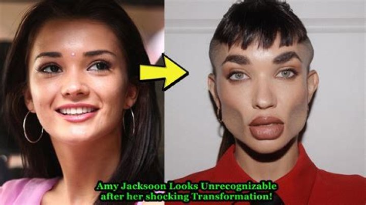Does Amy Jackson have plastic surgery?