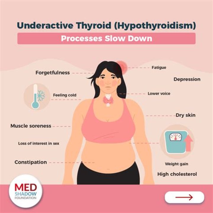 Does thyroid medication cause leg cramps?