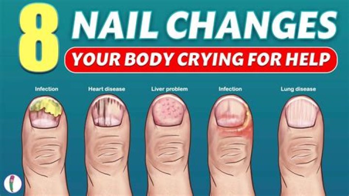 Does vitamin D affect nails?