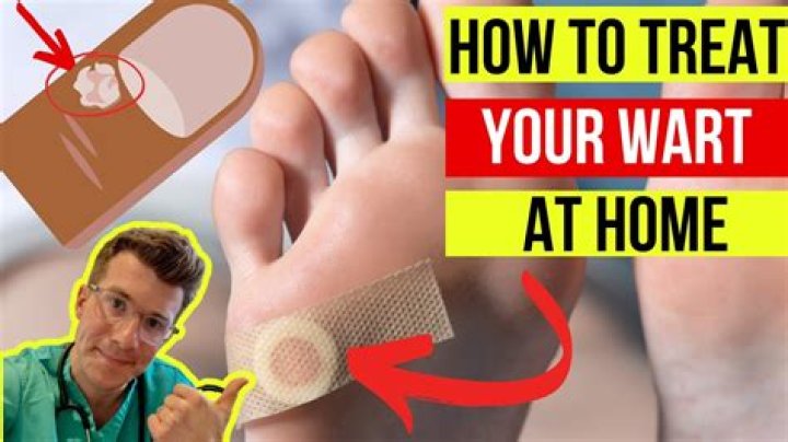 How do I treat a love bite?