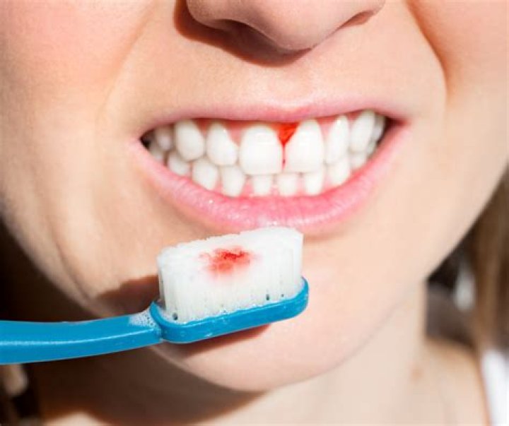 How do patient most often seek periodontal care?
