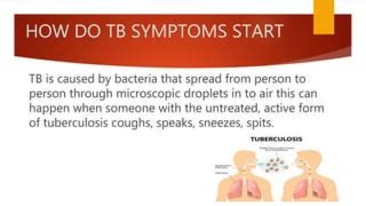 How do TB symptoms start?