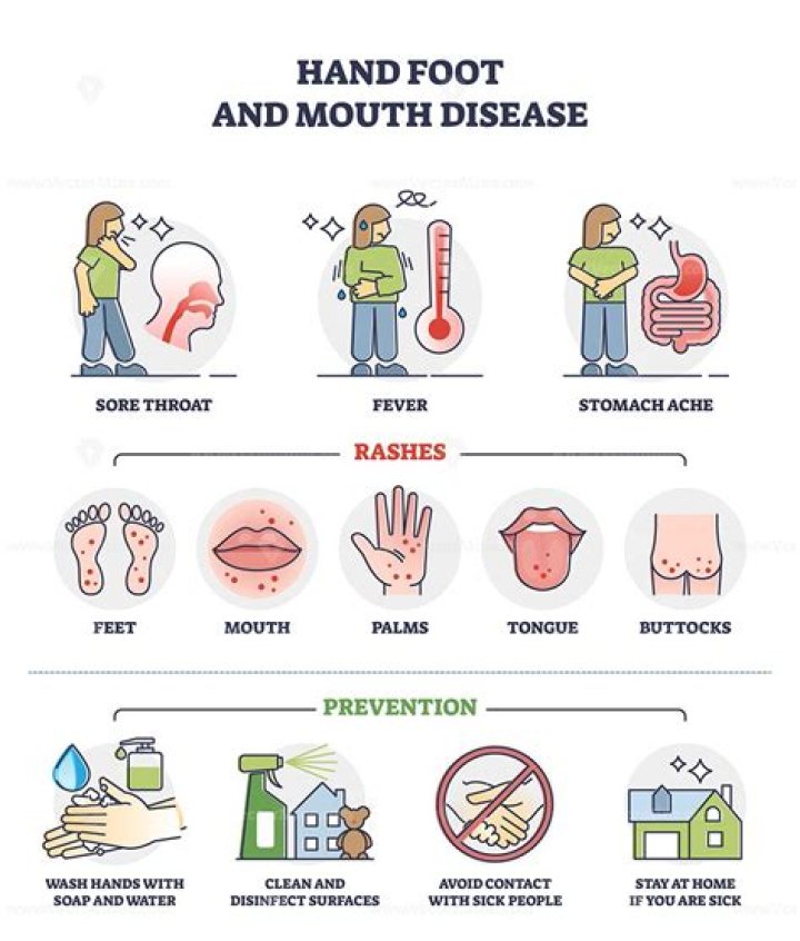 How do you get rid of hand, foot, and mouth disease fast?