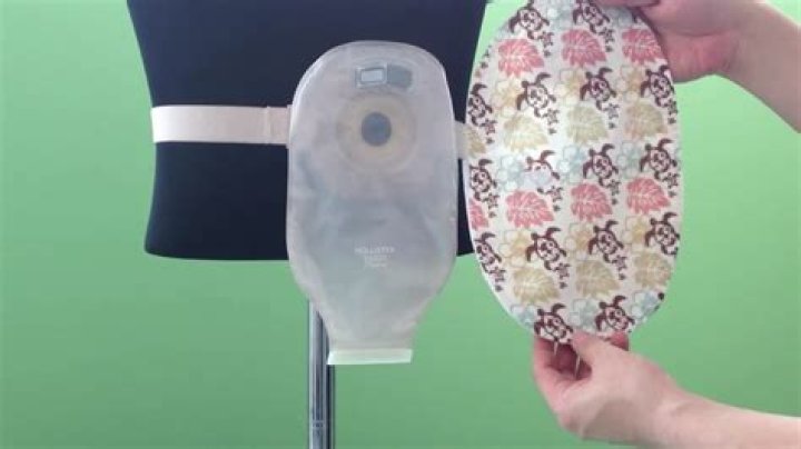 How do you hide an ostomy bag?