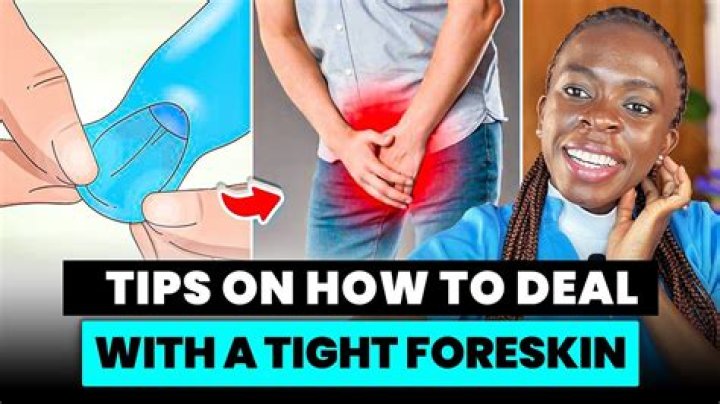 How do you open a tight foreskin?