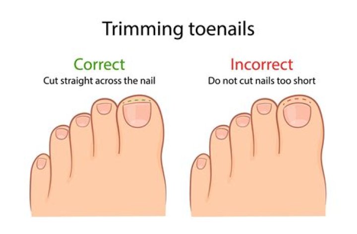 How do you shape your toenails?