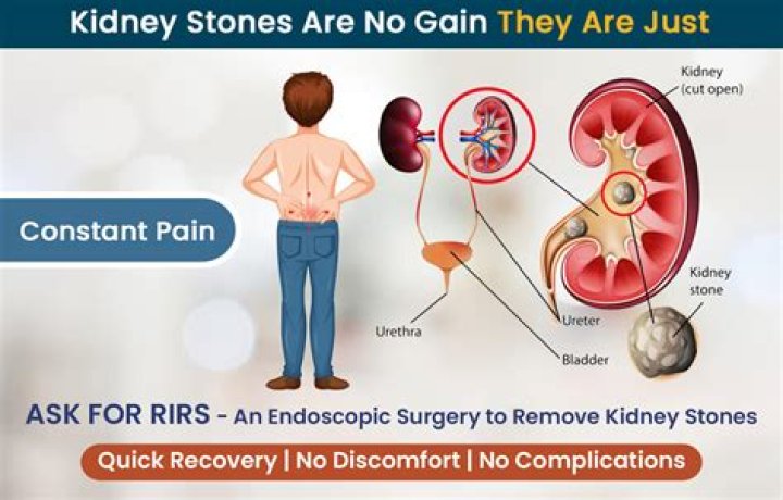 How does a kidney stone feel?
