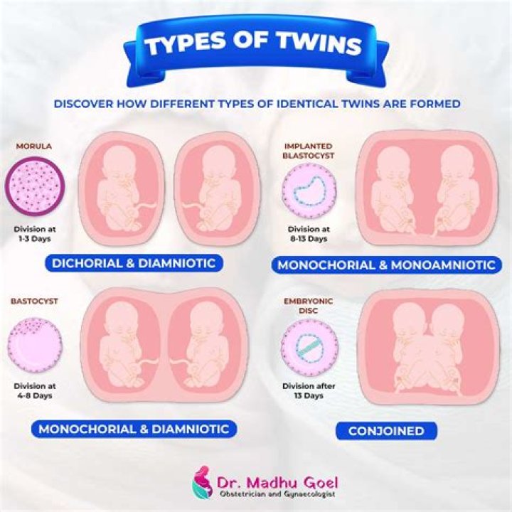 How does the death of a twin affect the other twin?