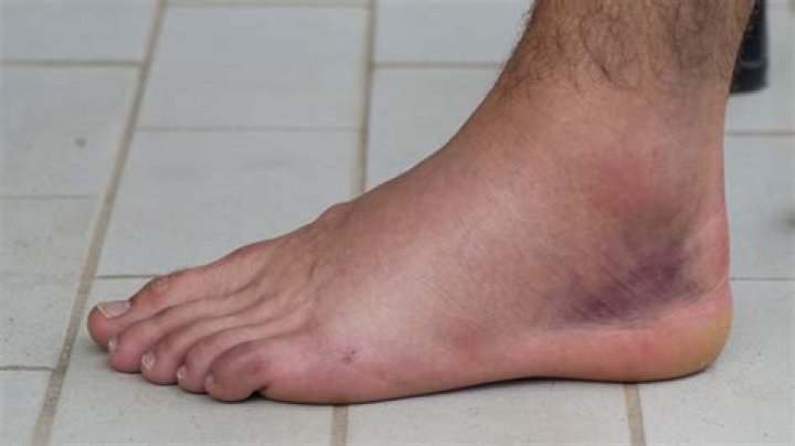 How long does it take for RA to damage joints?
