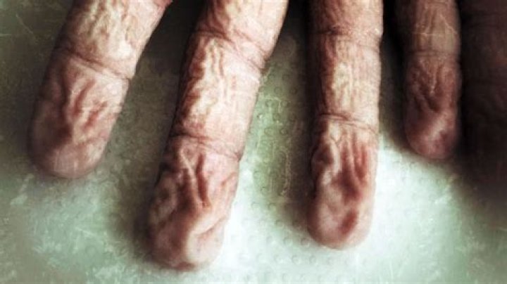 How long does it take skin to wrinkle in water?