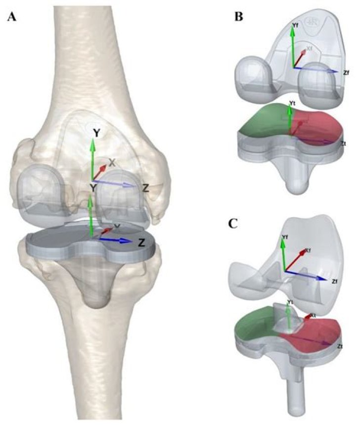 How long is the cut for a knee replacement?