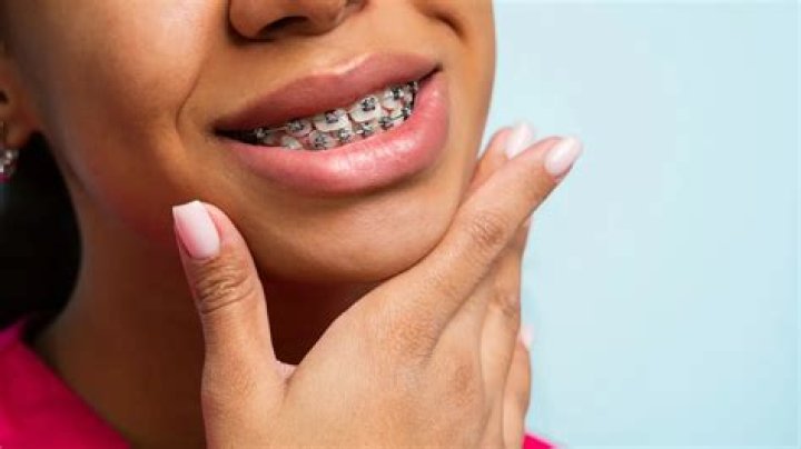 How much do braces hurt?
