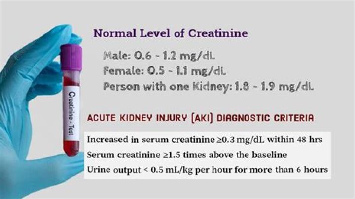 Is 133 creatinine level high?