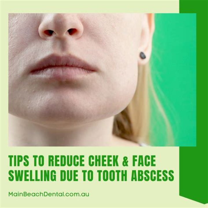 Is swollen cheek a dental emergency?