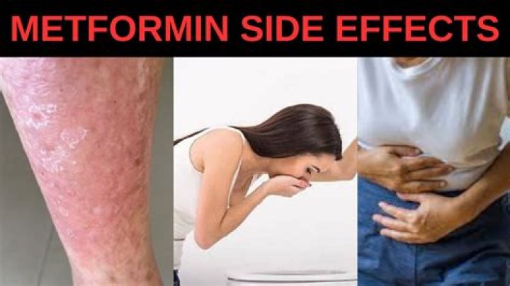 What are the long term side effects of metformin?