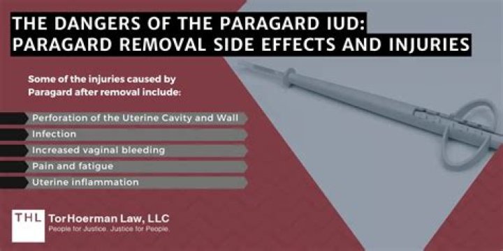 What are the side effects of Paragard?