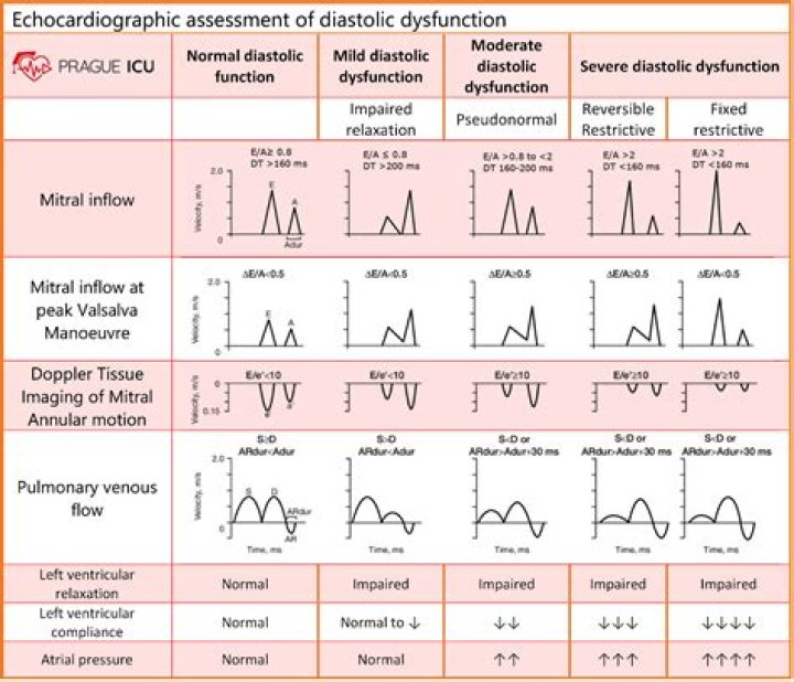 What are the stages of diastolic dysfunction?