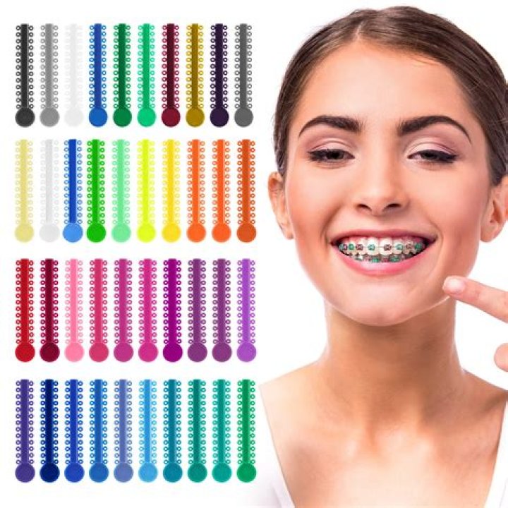 What are the ugliest braces colors?