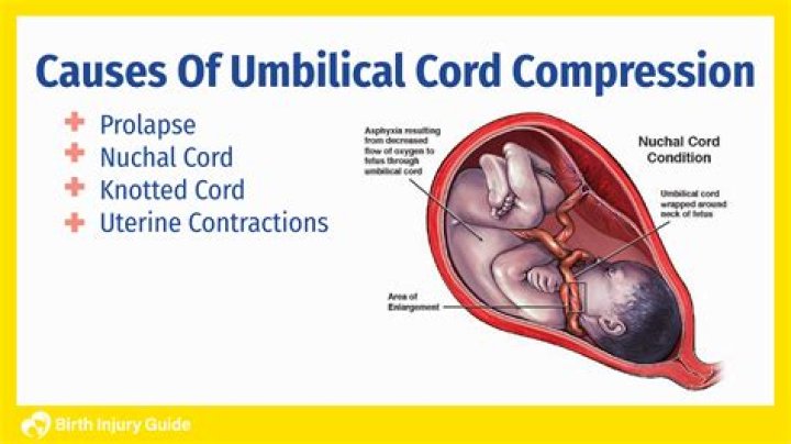 What does a healing umbilical cord look like?