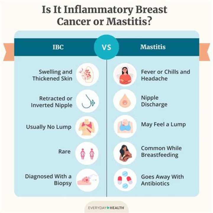 What does mastitis feel like in breasts?