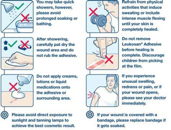 What happens if surgical glue comes off too soon?