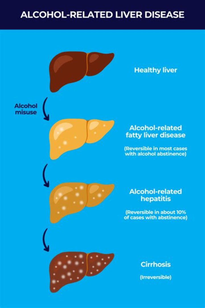What happens to your liver when you drink alcohol everyday?
