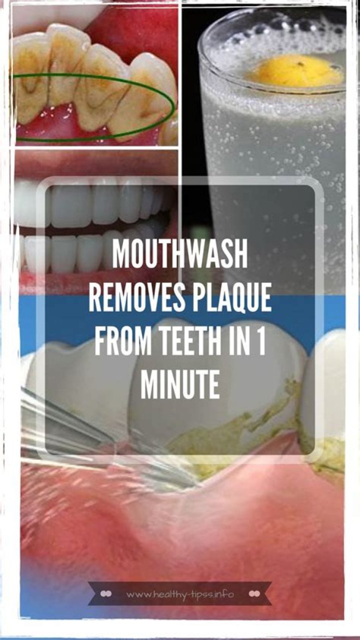 What homemade mouthwash removes plaque?