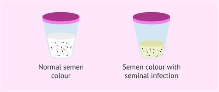 What is the color of a healthy sperm?