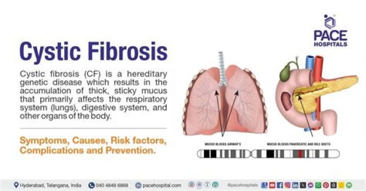 What is the nickname for cystic fibrosis?