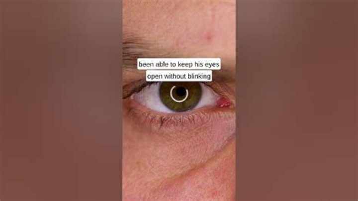 What is the world record of not blinking?