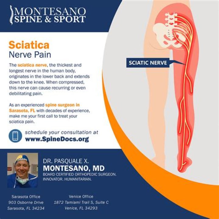 What kind of doctor do you see for sciatica nerve pain?