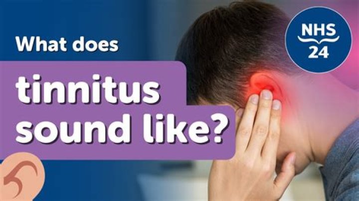 What tests do ENT do for tinnitus?