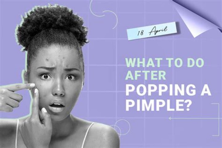What to do after popping a pimple?