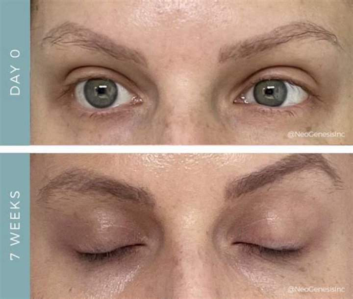 When do you lose your eyelashes during chemo?