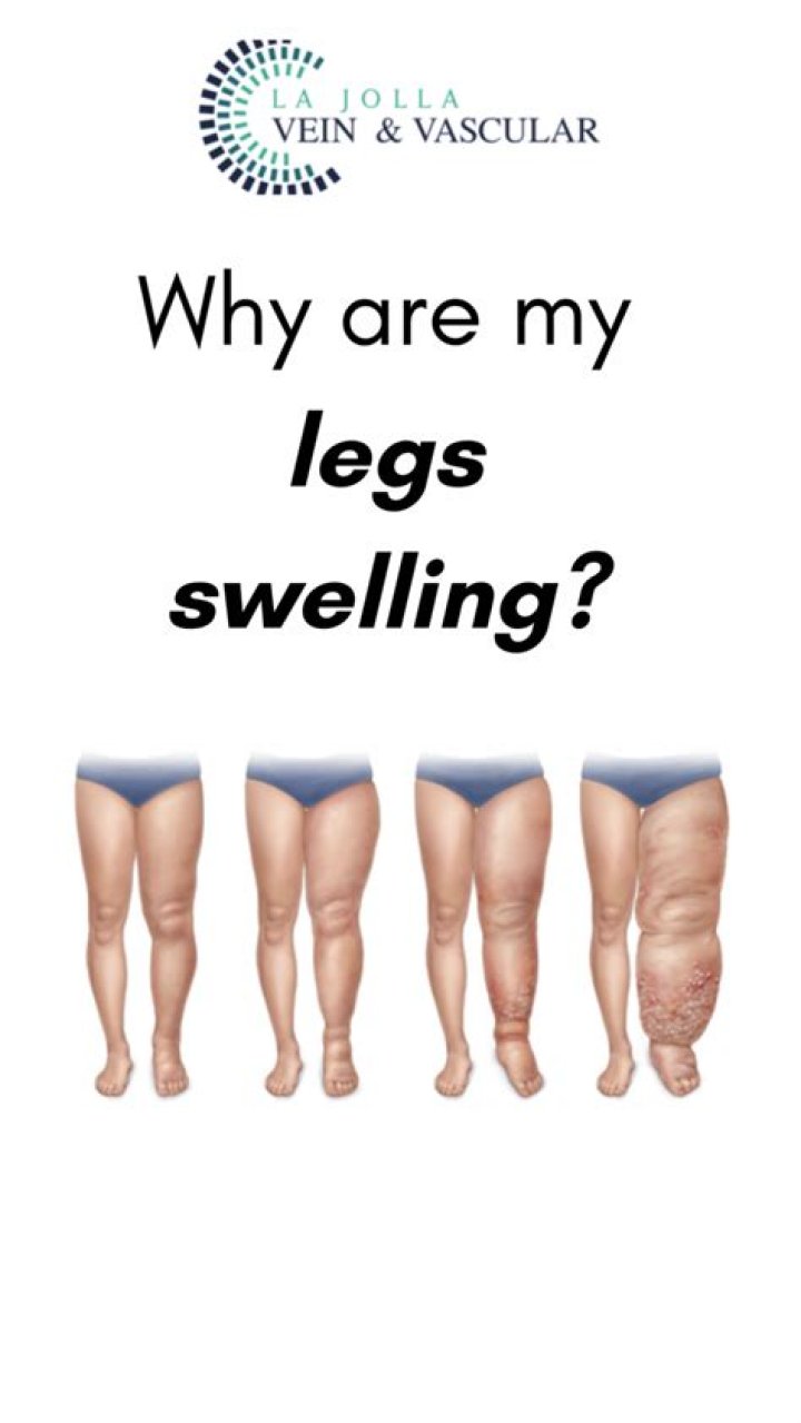 Why are my legs so dimply?