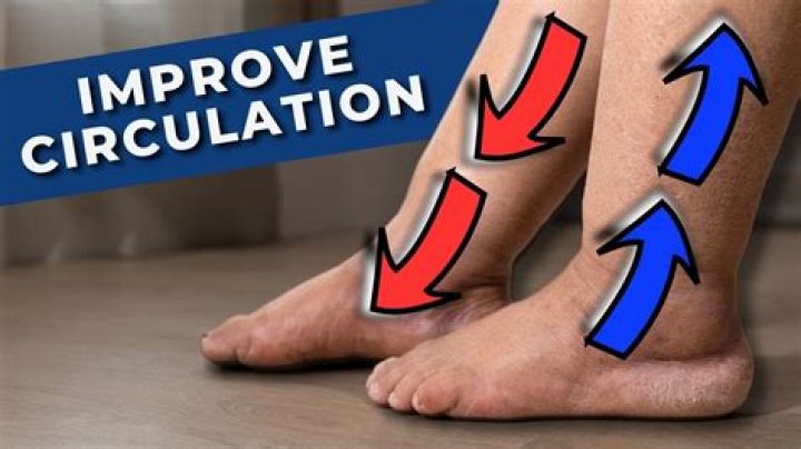 Why do I have poor circulation in my legs?